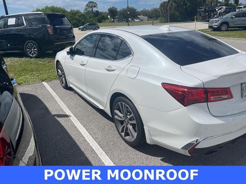 2019 Acura TLX V6 Advance