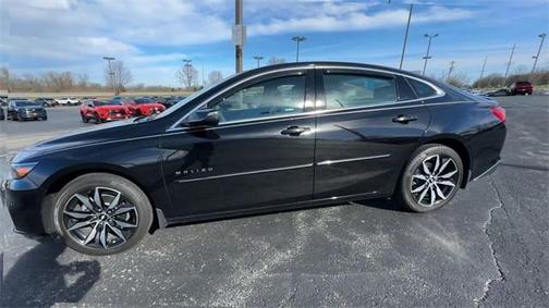 2017 Chevrolet Malibu 1LT