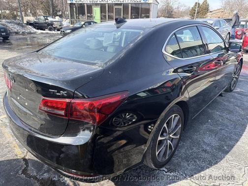 2015 Acura TLX V6