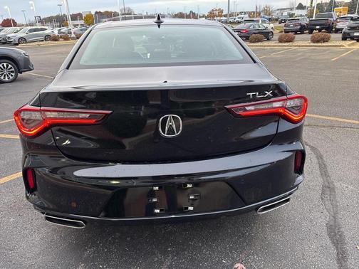 2025 Acura TLX Technology