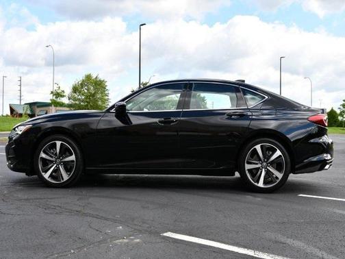 2025 Acura TLX Technology