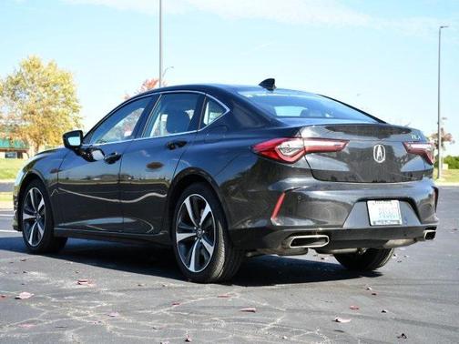 2025 Acura TLX Technology