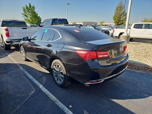 2018 Acura TLX Technology