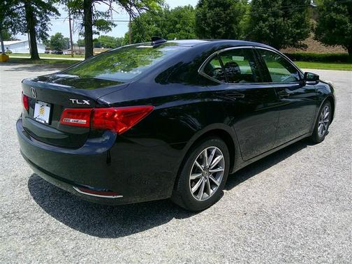 Crystal Black Pearl 2018 Acura TLX Technology
