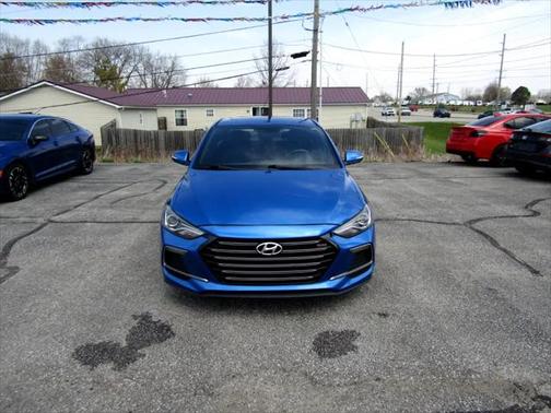2018 Hyundai ELANTRA Sport