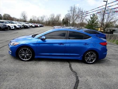 2018 Hyundai ELANTRA Sport