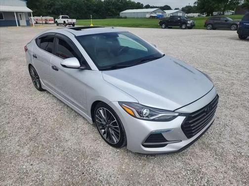 2018 Hyundai ELANTRA Sport