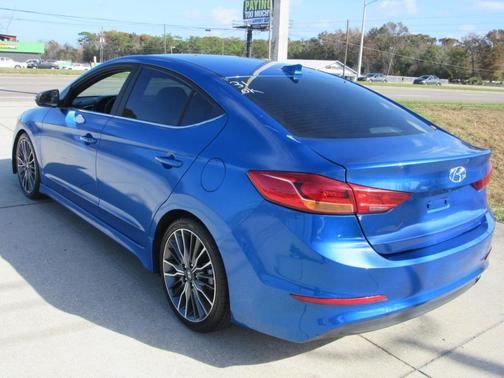 2018 Hyundai ELANTRA Sport