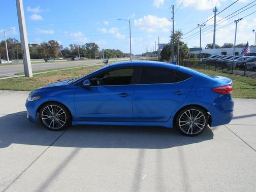 2018 Hyundai ELANTRA Sport