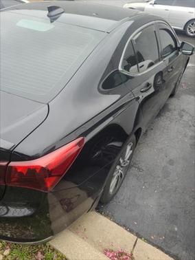 2015 Acura TLX V6 Tech