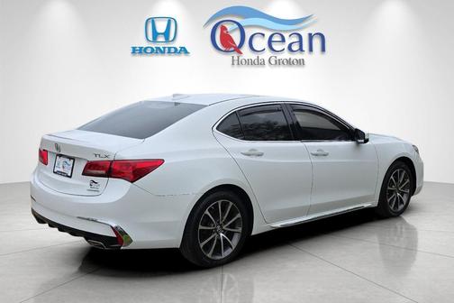 -Select- 2018 Acura TLX Technology