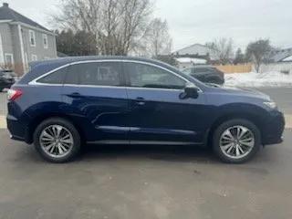 2017 Acura RDX Advance Package