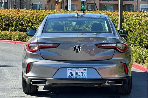 Carbon 2025 Acura TLX Technology