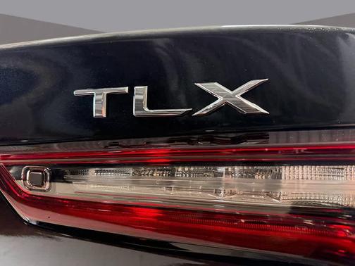 2025 Acura TLX Technology