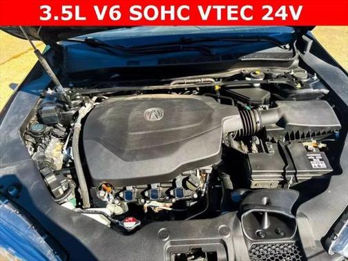 2018 Acura TLX Technology
