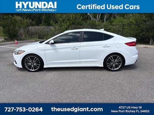 2018 Hyundai ELANTRA Sport