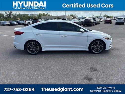 2018 Hyundai ELANTRA Sport