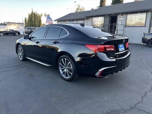 2018 Acura TLX Technology