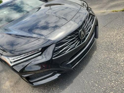 Black 2025 Acura TLX Tech