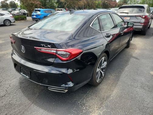 Black 2025 Acura TLX Tech