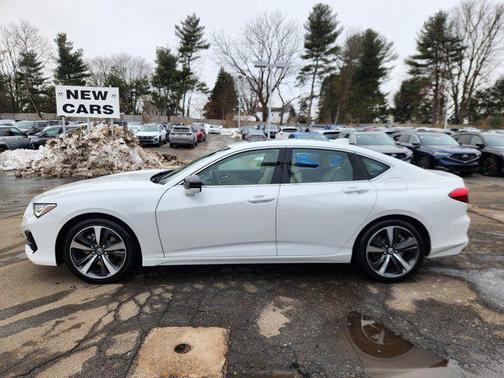 2025 Acura TLX Technology