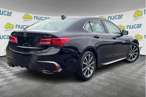 2018 Acura TLX Technology