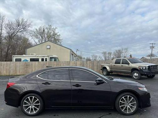 2015 Acura TLX V6