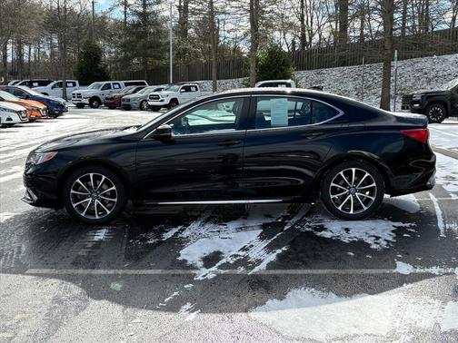 2018 Acura TLX Technology