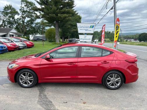 2017 Hyundai ELANTRA SE Value Edition