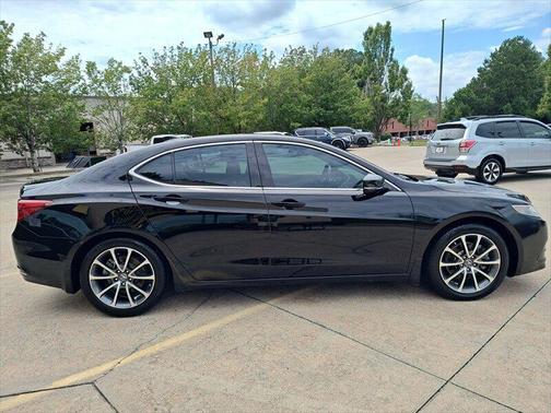 2017 Acura TLX w/Technology Package
