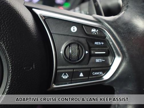 2021 Acura TLX Technology