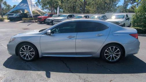 2018 Acura TLX Technology