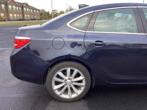 2015 Buick Verano Convenience Group