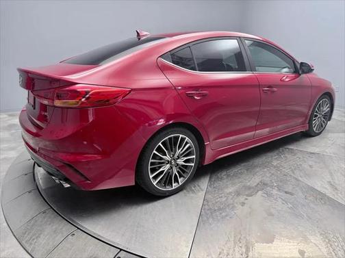 2018 Hyundai ELANTRA Sport