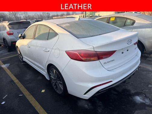 2018 Hyundai ELANTRA Sport