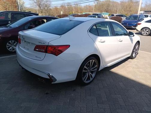 2020 Acura TLX Technology