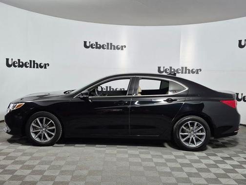 Crystal Black Pearl 2018 Acura TLX Technology