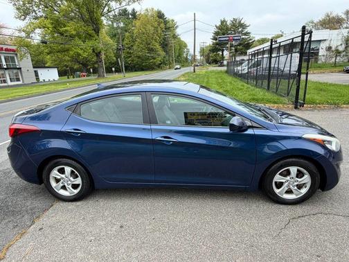 Lakeside Blue 2015 Hyundai ELANTRA SE