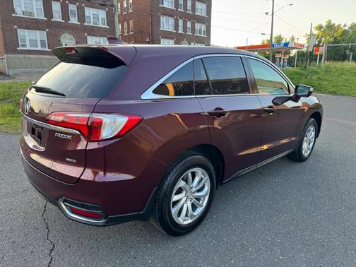 2017 Acura RDX Technology & AcuraWatch Plus Packages