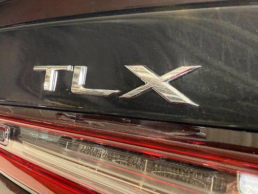 2025 Acura TLX A-Spec