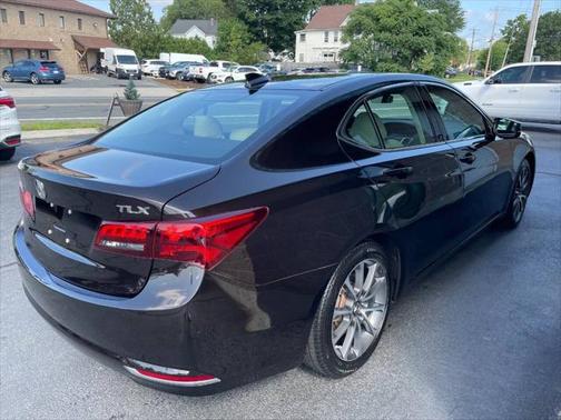 2015 Acura TLX V6 Tech