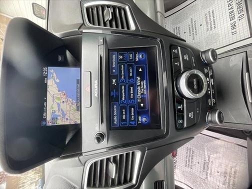 2017 Acura RDX Technology Package