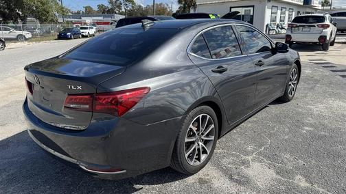 2015 Acura TLX V6