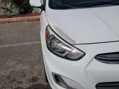 Century White 2017 Hyundai Accent Value Edition