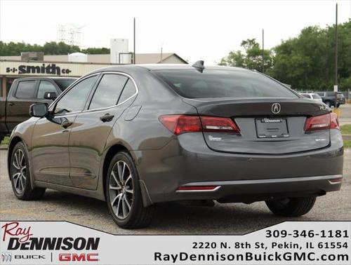 2016 Acura TLX V6 Advance