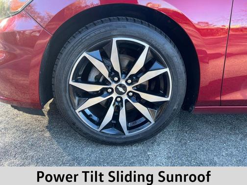 2017 Chevrolet Malibu 1LT