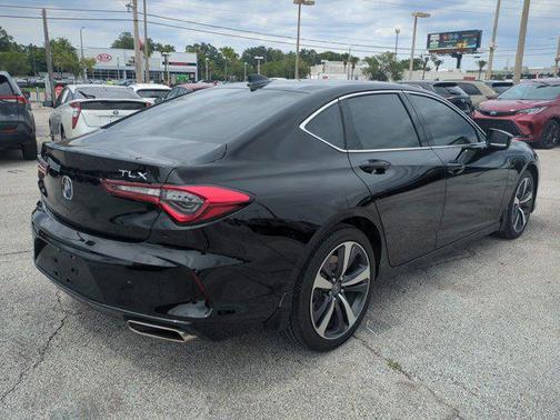 2025 Acura TLX Technology