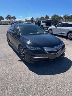 2015 Acura TLX V6 Tech
