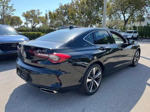 2025 Acura TLX Technology