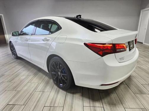 2015 Acura TLX V6 Tech